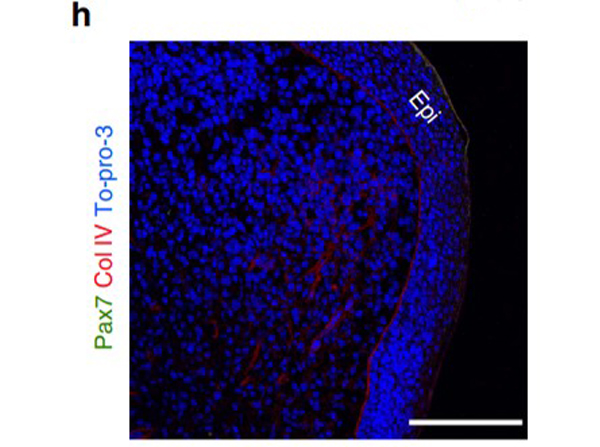 Immunohistochemistry of Anti-Collagen Type IV Antibody Biotin Conjugated