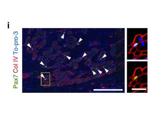 Immunohistochemistry of Anti-Collagen Type IV Antibody Biotin Conjugated