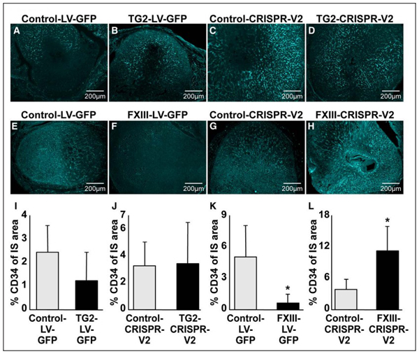 Immunohistochemistry of Anti-Collagen Type IV Antibody Biotin Conjugated