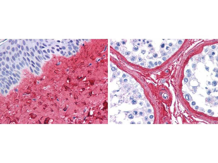 Collagen Type III Antibody