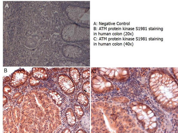 ATM Protein Kinase S1981 Antibody