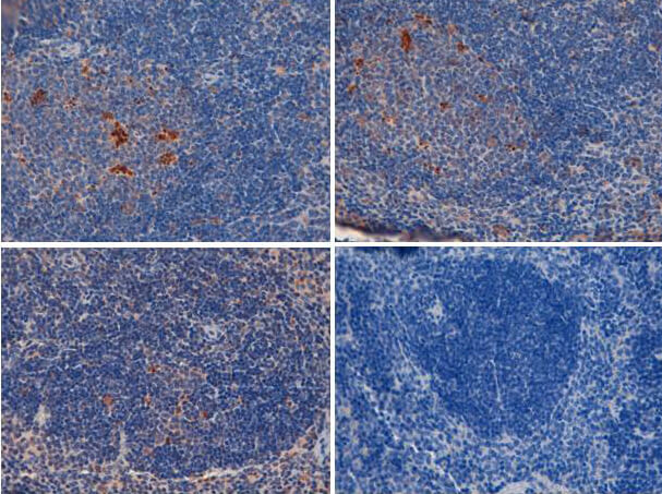Anti-TLR2 Antibody - Immunohistochemistry
