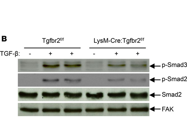 Western Blot using Smad3 pS426pS425