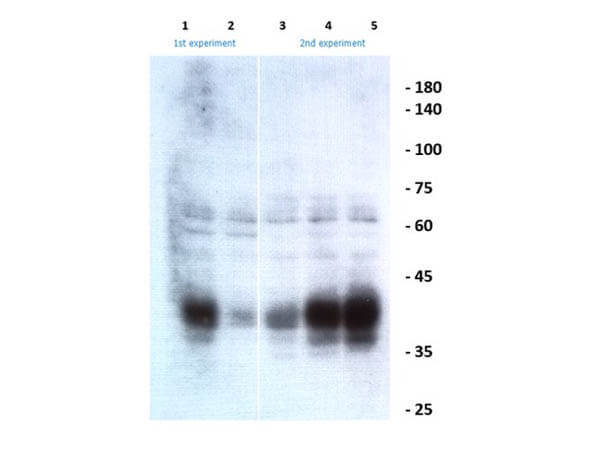 Western Blot of Rabbit Anti-Ephrin B1-B3 Antibody