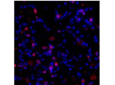 Collagen I alpha 1 propeptide Antibody