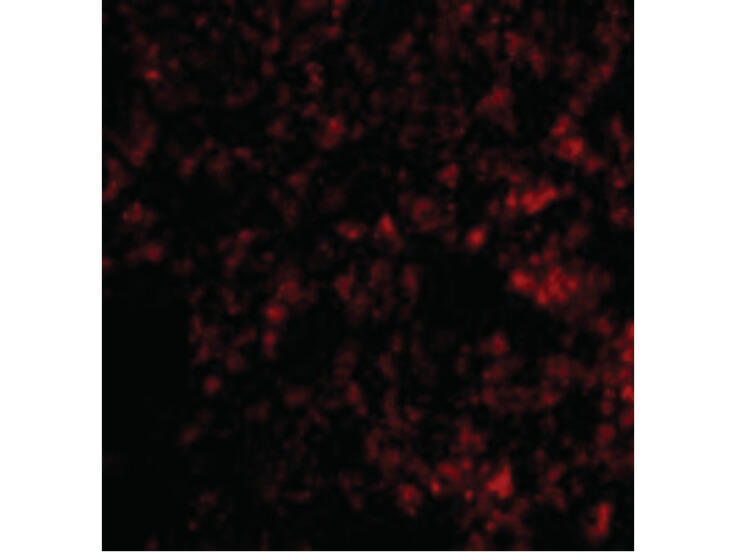 Immunofluorescence of Blimp-1 Antibody