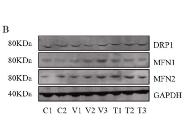 Western blot results using goat Anti-Rabbit IgG DyLight800