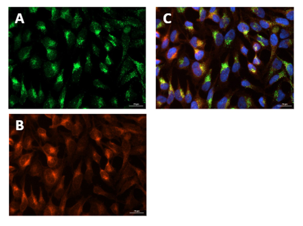 Immunofluorescence using Goat Anti-Rabbit IgG Texas Red