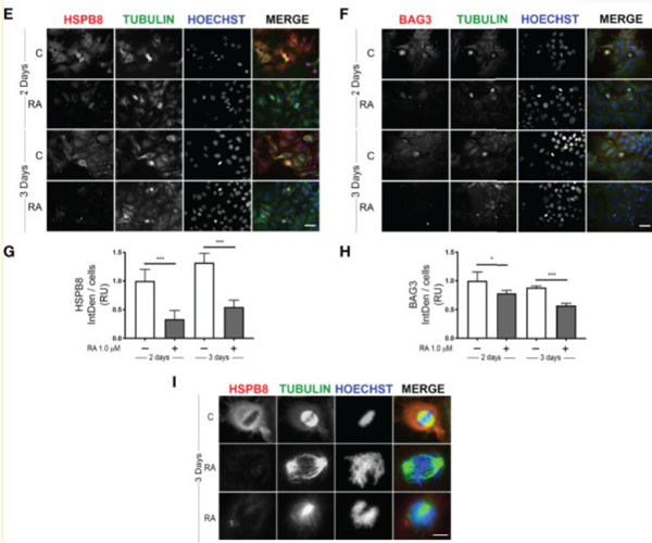 Immunofluorescence results with Donkey Anti-Rabbit IgG Rhodamine