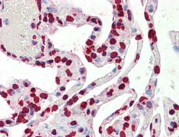 Immunohistochemistry- Histone 3