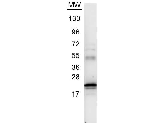 IL-6 Antibody