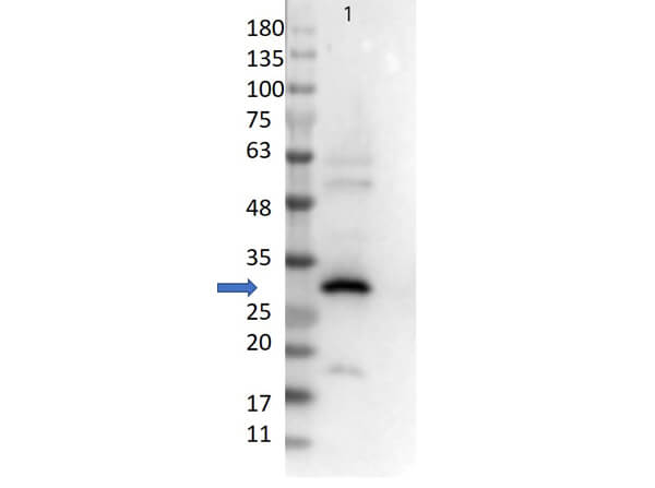 RFP Antibody