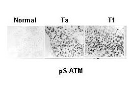 Anti-ATM Monoclonal Antibody - Immunohistochemistry