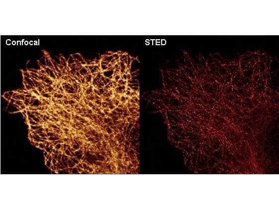 Anti-alpha-Tubulin Monoclonal Antibody - Immunofluorescence Microscopy