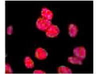 ATM phospho S1981 Peroxidase Conjugated Antibody