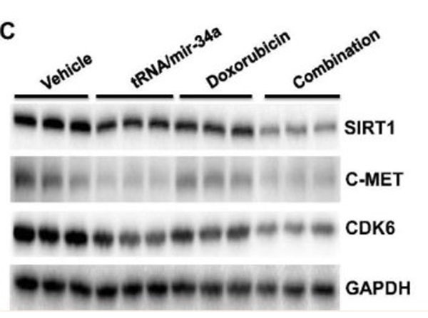 RIPA used for western blot