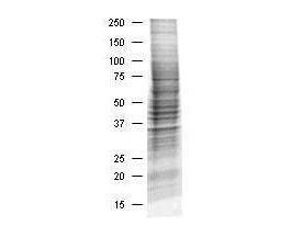 HEK293 Whole Cell Lysate Insulin Stimulated