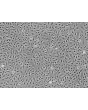 Human_Umbilical_Vein_Endothelial_Cells (HUVEC) - Phase contrast, 100x. 