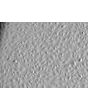 Human_Umbilical_Vein_Endothelial_Cells (HUVEC) - Relief contrast, 200x. 