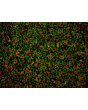 Human_Umbilical_Vein-Endothelial Cells (HUVEC) – Immunofluorescence for CD31 (R&D Systems Cat.#BBA7), 200x. 