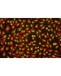 Human_Umbilical_Vein_Endothelial_Cells (HUVEC) – Immunofluorescence for vWF (Sigma-Aldrich Cat.#F3520), 200x. 