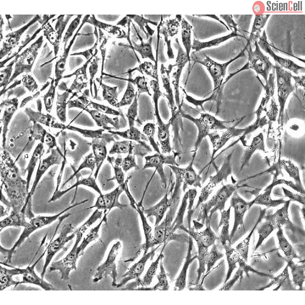 Human Skeletal Muscle Satellite Cells (HSkMSC) - Phase contrast, 200x. 