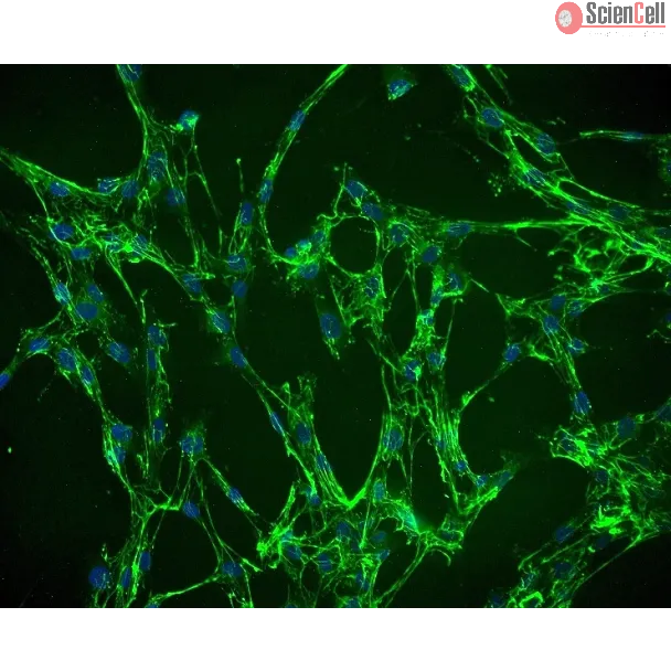Human Villous Mesenchymal Fibroblasts (HVMF) - Immunostaining for Fibronectin, 200x. 