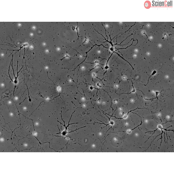 Mouse Neurons-spinal cord (MN-sc) - Phase contrast, 200x. 