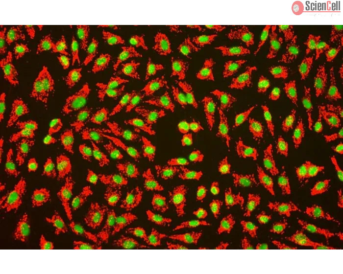 Human_Umbilical_Vein_Endothelial_Cells (HUVEC) – Immunofluorescence for vWF (Sigma-Aldrich Cat.#F3520), 200x. 