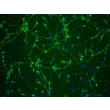 Mouse Neurons-spinal cord [MN-sc] - Immunostaining for β-Tubulin III, 200x. 