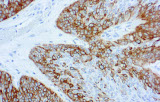 Anti-citoqueratina 14 CE/IVD para IHC - Patologia geniturinária