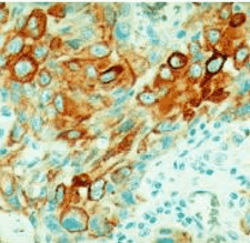 Anticorpo monoclonal anti-citoqueratina Clone KL1