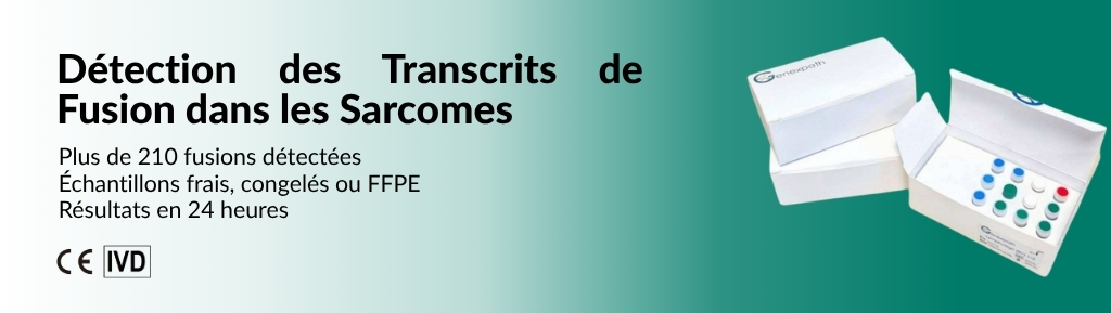 Sarcoma diagnostic in a single reaction