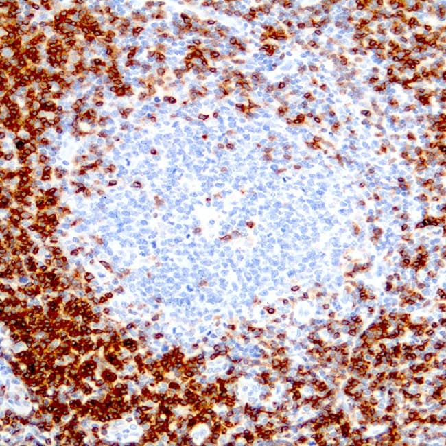 célula Exceder elemento Anti-CD3 CE/IVD para IHC - Hematopatología Clinisciences