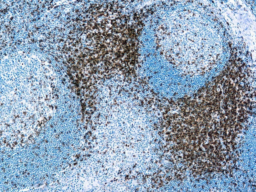 Anti-CD3 CE/IVD para IHC - Hematopatologia Clinisciences