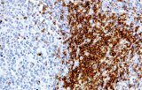 CD7