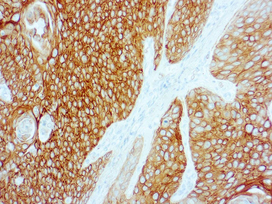 Anti Cytokeratin 5 6 Ce Ivd For Ihc Genitourinary Pathology Clinisciences