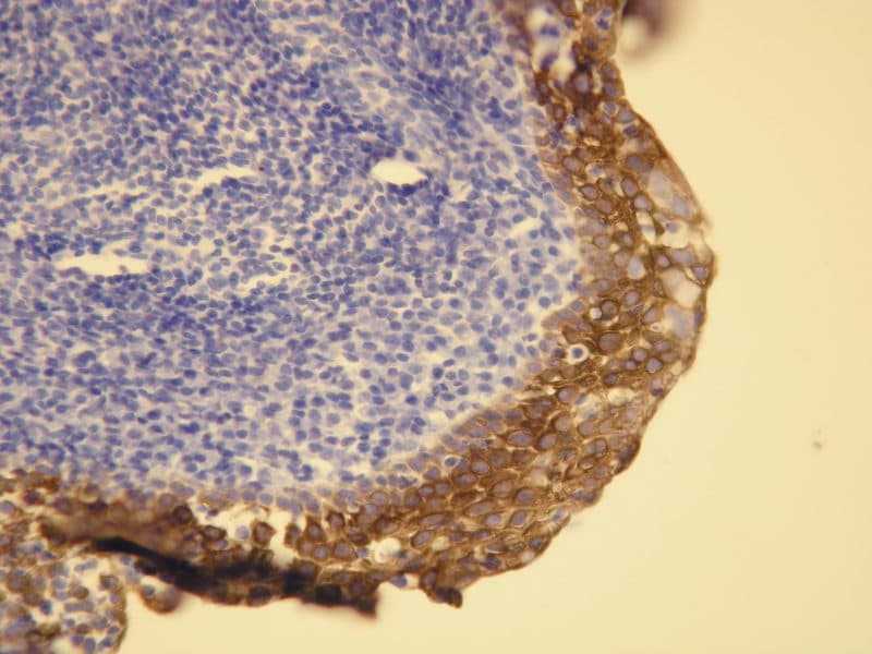 Anti Cytokeratin 5 6 Ce Ivd For Ihc Gynecological Pathology Clinisciences