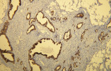 Cytokératine 7