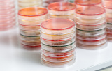 Boites de pétri pour la microbiologie
