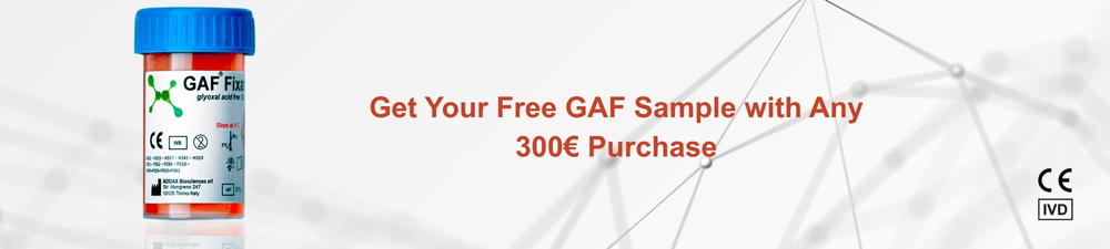 Lipid Nanoparticles Banner