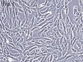 Cellules Souches Mesenchymateuses (CSM)