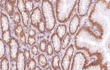 Anti-Actine du muscle lisse CE/IVD pour IHC - Pathologie des tissus mous