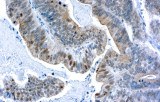 Anti-BRCA1 CE/IVD pour IHC - Cytopathologie