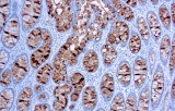 Anti-CA 19-9 CE/IVD pour IHC - pathologies gastro-intestinales