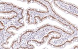Anti-CDX-2 CE/IVD pour IHC - pathologies gastro-intestinales