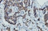 Chromogranine A