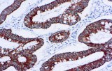 Anti-Cytokératine 18 CE/IVD pour IHC - pathologies uro-génitales