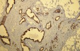 Cytokératine 7