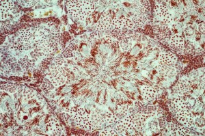 Vos résultats IHC en 30 minutes